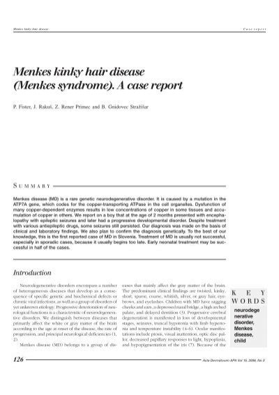 Menkes Kinky Hair Disease Menkes Syndrome A Case Report