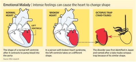 Broken Heart Syndrome Takotsubo Cardiomyopathy Vlrengbr