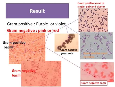 Gram Stain Introduction Principle Procedure Result And Interpretation