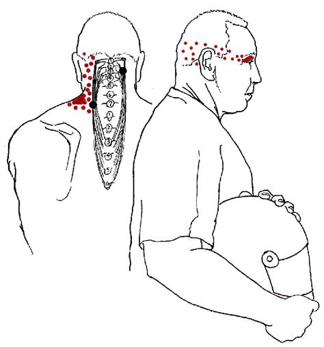 Round Earth Publishing Introduction To Head Pain Posture Exercises