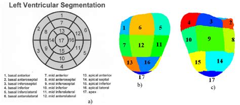 A The Aha 17 Segment Model For Myocardial Segmentation Figure