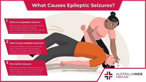 What Causes Epileptic Seizures Youtube
