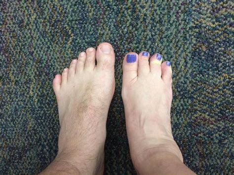 I Was Born With 6 Toes On My Left Foot And My Co Worker Was Born With 4 Toes On Her Right Foot