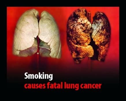 Lung cancer screening programs may provide opportunities to reduce smoking rates among participants. Smoking and cancer | ENCOGNITIVE.COM