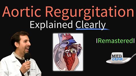 Aortic Regurgitation Aortic Insufficiency Explained Clearly