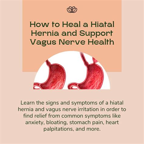 How To Heal A Hiatal Hernia And Support Vagus Nerve Health