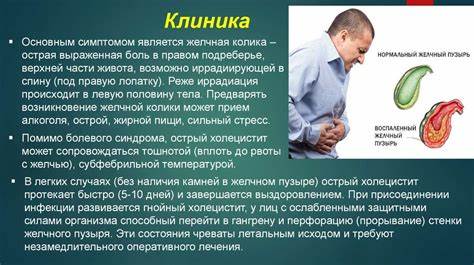 Острый холецистит диеты Острый холецистит - презентация онлайн Острый холецистит - презентация онлайн Острый холецистит диеты