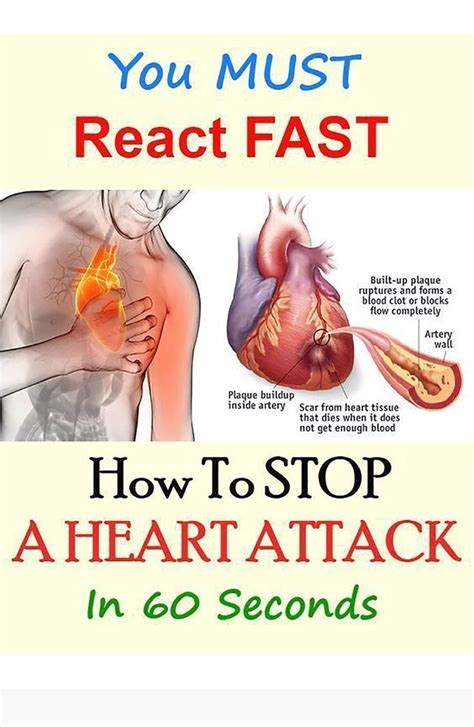 How To Stop A Heart Attack In 1 Minute In 2020 Heart Attack Remedies