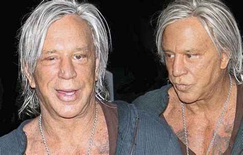 Mickey Rourke Plastic Surgery Before And After