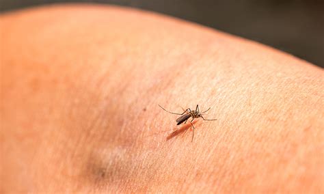 Why Do Mosquito Bites Itch What You Didnt Know About Mosquitoes