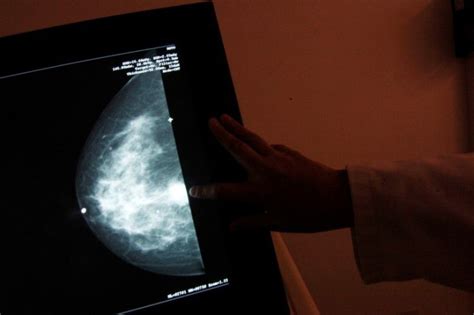 new breast cancer guidelines recommend average risk women get first mammogram at age 50 why wait