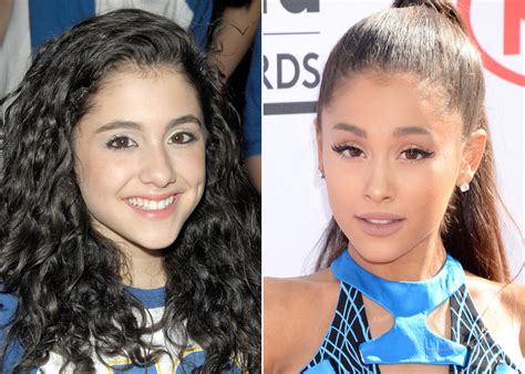 Ariana Grande Before And After Plastic Surgery Including