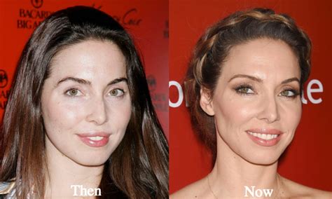 Whitney Cummings Plastic Surgery Before And After Photos Latest