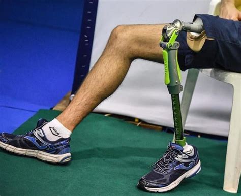 Amputee Legs Stumps And Prostheses In 2020 Legs Prosthetics Amputee