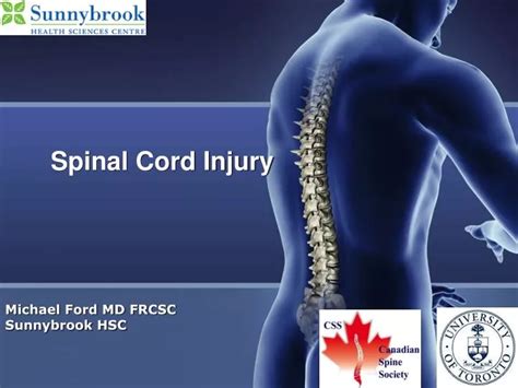 Ppt Spinal Cord Injury Powerpoint Presentation Free Download Id
