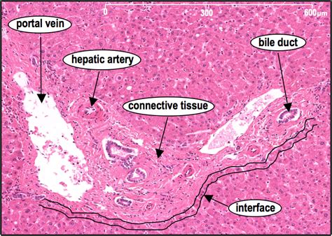 Liver Portal Triad Histology Slide Labeled