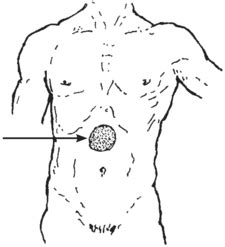 They are just below the rib cage. Dor de barriga ou intestinal - Hesperian Health Guides