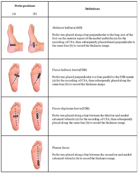 Ijerph Free Full Text Contribution Of Plantar Fascia And Intrinsic Foot Muscles In A Single