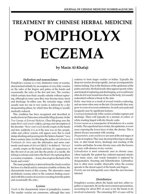 Pompholyx Eczema Treatment By Chinese Herbal Medicine