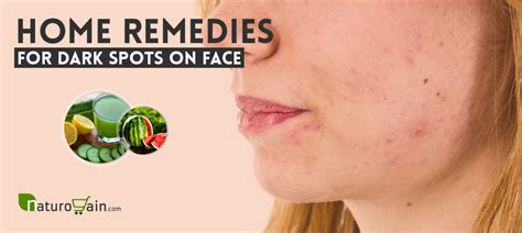 7 Simple And Best Home Remedies For Dark Spots On Face