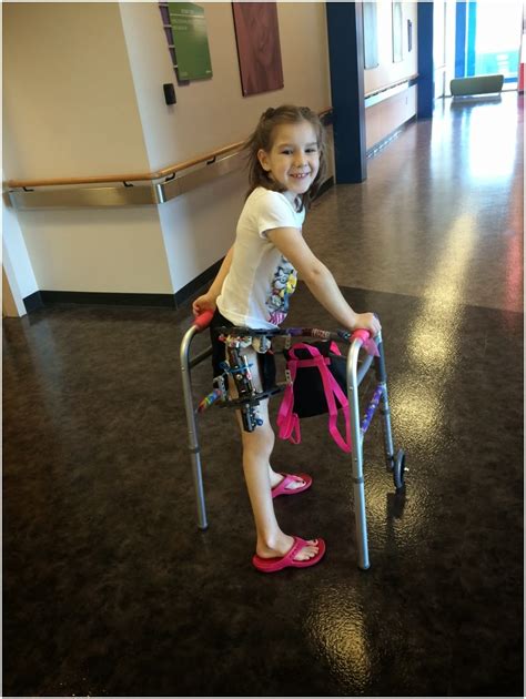 Avas Journey With Perthes Disease Its Hour By Hour