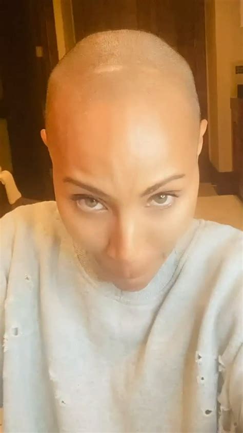 Jada Pinkett Smith Mostró El Avance De Su Lucha Contra La Alopecia Y