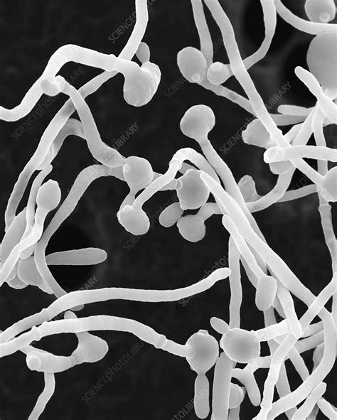 Candida Albicans Yeast And Hyphae Stages Sem Stock Image C0370228