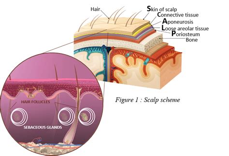 Hot Topic Skinification Of The Scalp