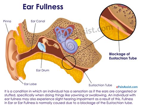 Ear Fullnesscausessymptomstreatmenthome Remedies