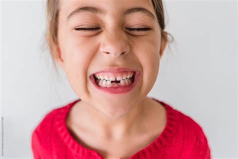 Smiling Girl Showing Her Missing Teeth Stocksy Lost Tooth Hd Wallpaper Pxfuel