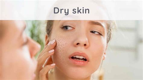 Dry Skin How To Moisturize It Naturally Stressapp