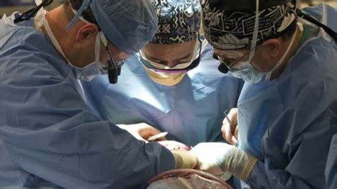 Chimp Attack Woman Charla Nash Has Full Face Transplant Bbc News