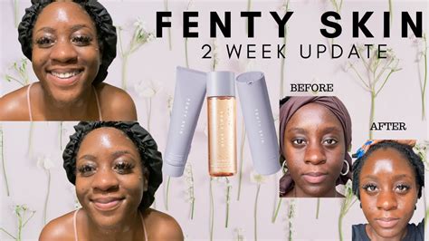 Fenty Skin Review With Before And After Pics Youtube