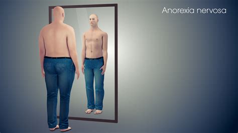Anorexia Nervosa Symptoms Causes And Treatment