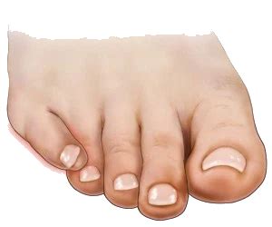 A hammer toes is a toe that is bent because of a muscle imbalance around the toe joints. What I Learned From My Pinky Toe : Transfigured Hearts