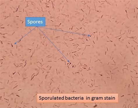 Sporulated Bacteria Introduction Mechanism Of Spore Formation