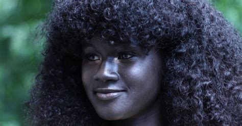 This Girl Was Bullied For Her Skin Color Now Shes A Badass Model