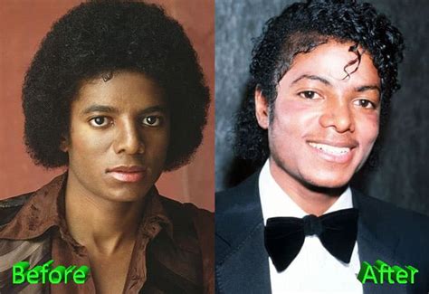 Michael Jackson Looked Better Before Plastic Surgery