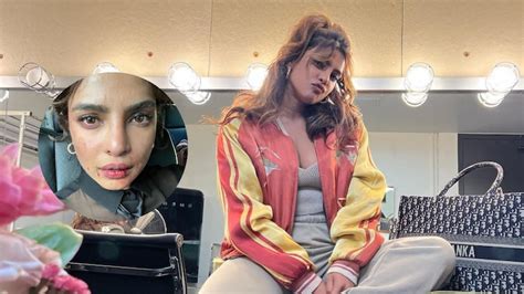 Priyanka Chopra Shares Pic Of Her Bruised Face Leaves Fans Confused