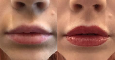 How my lip & brow tattoos turned out horribly wrong. Permanent Lip Color Tattoo Experience Photos