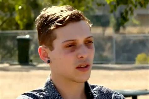 21 year old recounts alleged gay bashing by gang of teenagers they were stomping on my head
