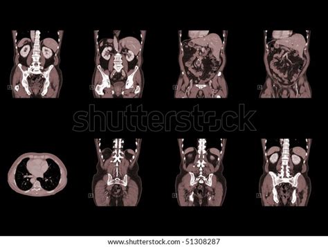 Ct Scan Human Body Isolated On Stock Photo 51308287 Shutterstock