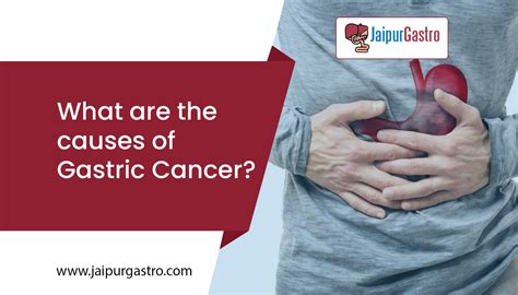 What Are The Causes Of Gastric Cancer In 2022 Jaipurgastro Clinic
