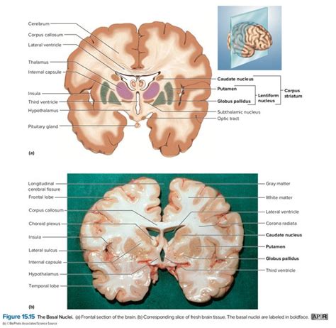 Is The Internal Capsule A Part Of The Basal Ganglia Quora