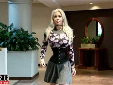 Woman Who Wants The World S Smallest Waist Gets 6 Ribs Removed