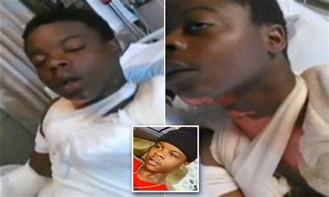 Atlanta Teen Burned After Being Attacked With Pot Of Boiling Rice While Sleeping Daily Mail Online