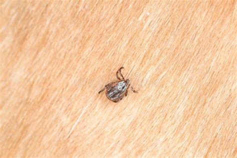 A Dangerous Tick On Human Skin Stock Photo Image Of Detail Flea