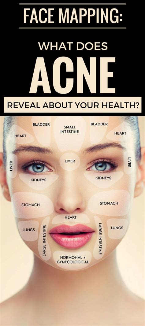 Face Mapping What Does Acne Reveal About Your Health Healthy Greens