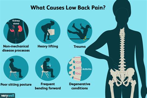 Back Pain Symptoms Causes And Treatment The Senior Digest