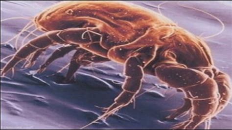 How To Contain Microscopic Dust Mites In Homes Wpxi